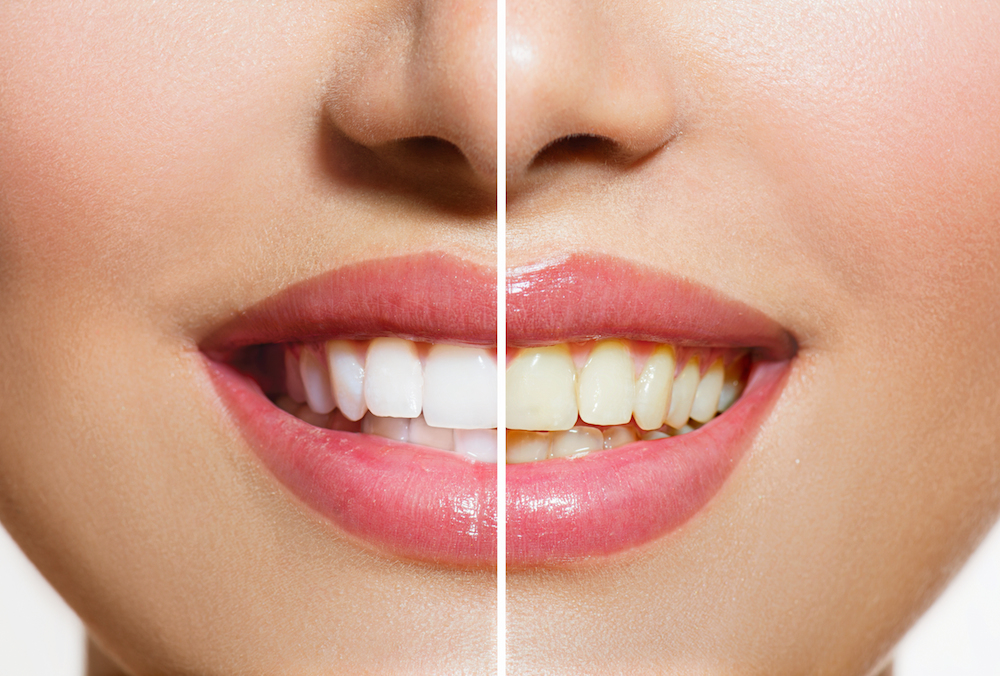 dentist in Sioux City